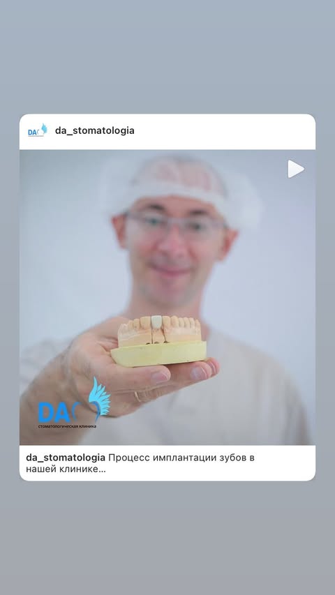 Имплантация зубов в клинике DA
